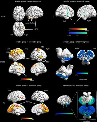 Exercise Intensity and Brain Plasticity: What’s the Difference of Brain Structural and Functional Plasticity Characteristics Between Elite Aerobic and Anaerobic Athletes?